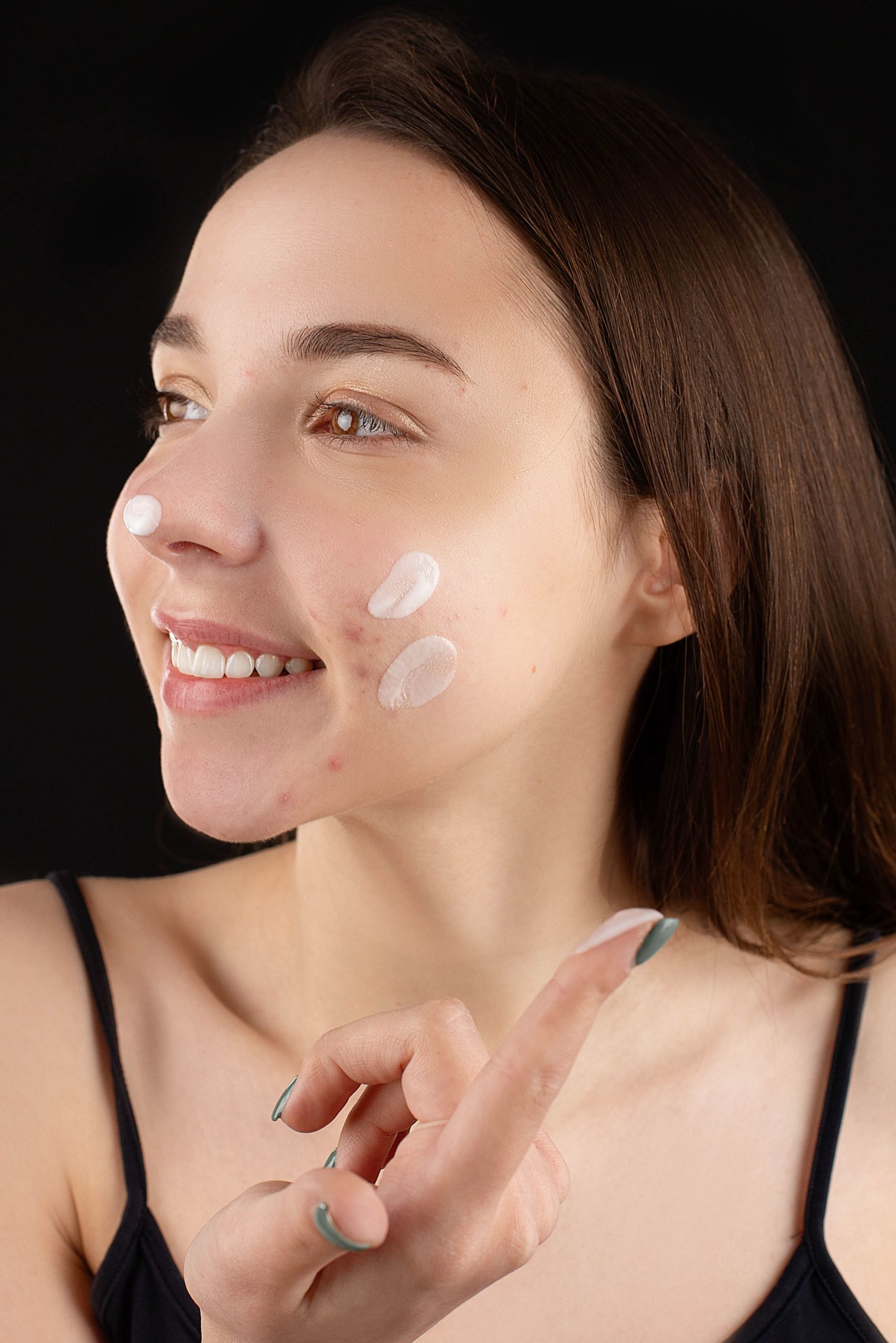 Skincare para controle de acne – evitando as espinhas